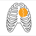 Heart-Failure-500x500-1.png
