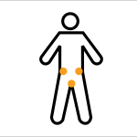 Interstitial-Cystitis-150x150-2.png